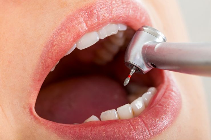 dentista en Getafe, clínica dental en Getafe