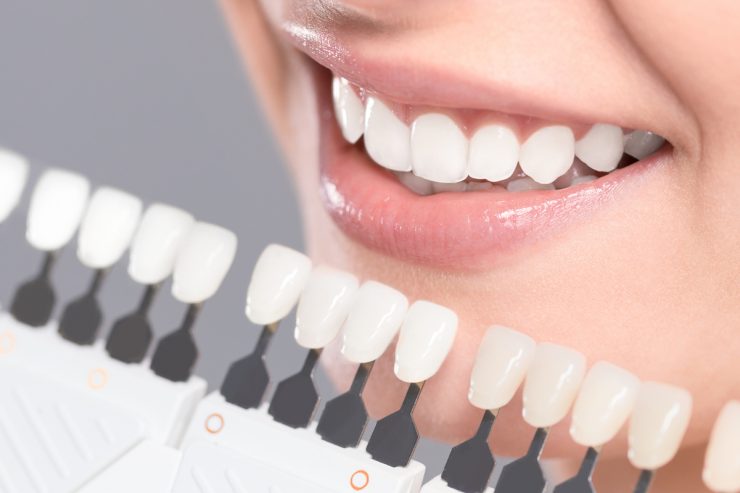 dentista en Getafe, clínica dental en Getafe