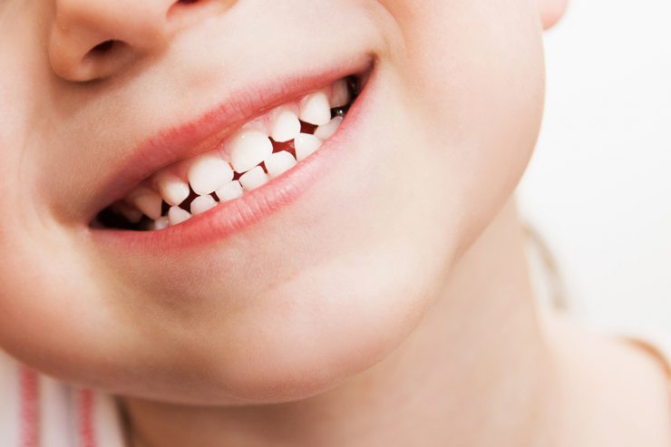 dentista en Getafe, clínica dental en Getafe