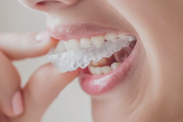 dentista en Getafe, clínica dental en Getafe