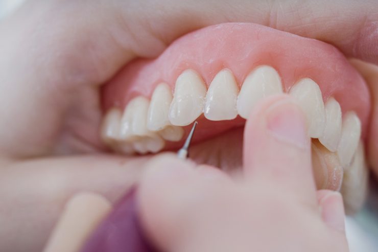 dentista en Getafe, clínica dental en Getafe