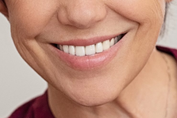 dentista en Getafe, clínica dental en Getafe