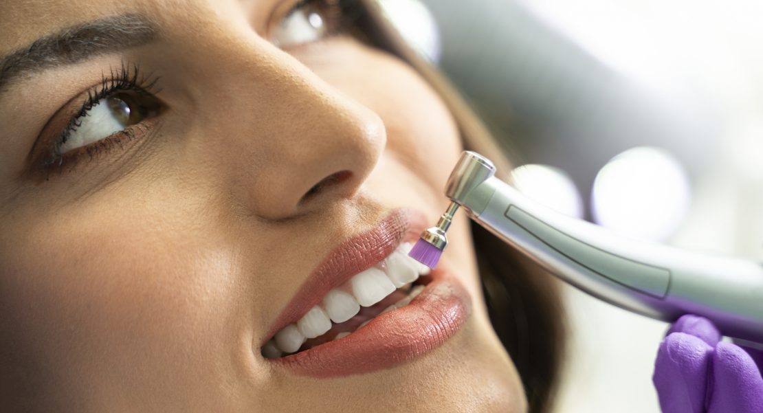 profilaxis dental