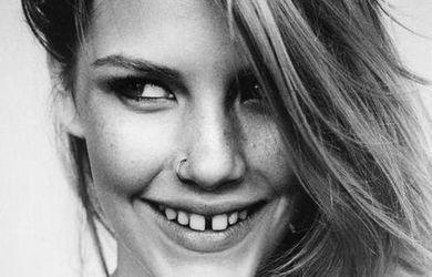 tratamientos para el diastema
