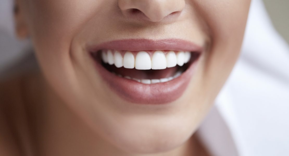 Blanqueamiento dental