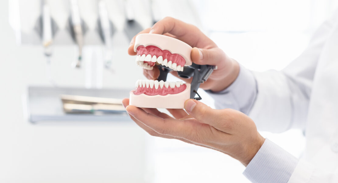 caries recurrentes