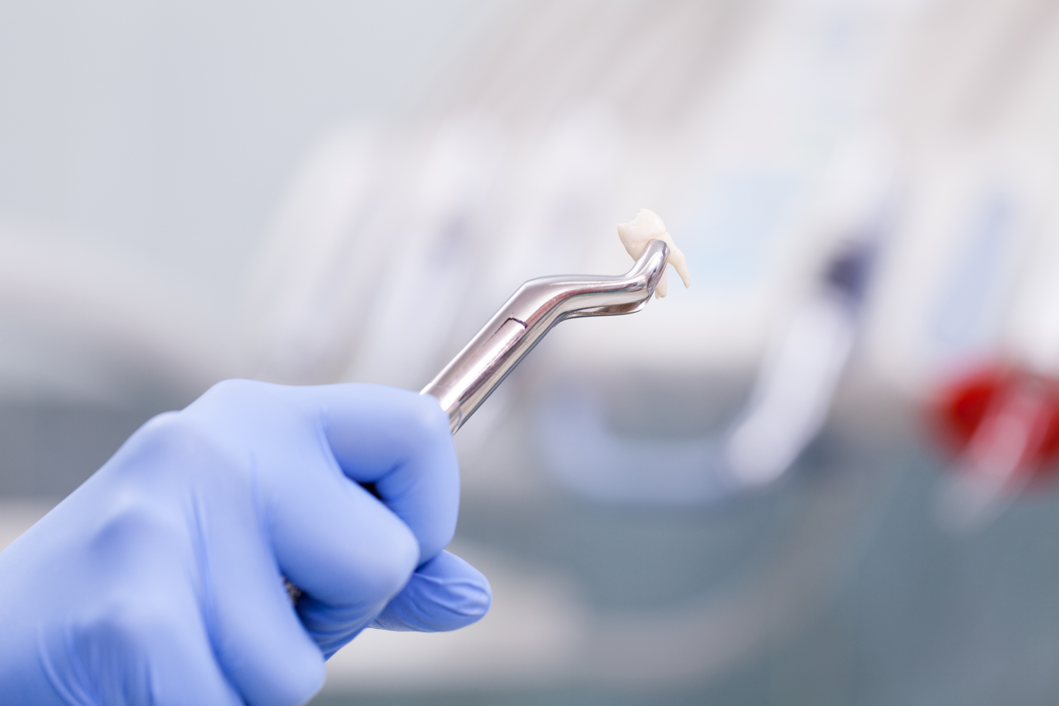 pérdida dental