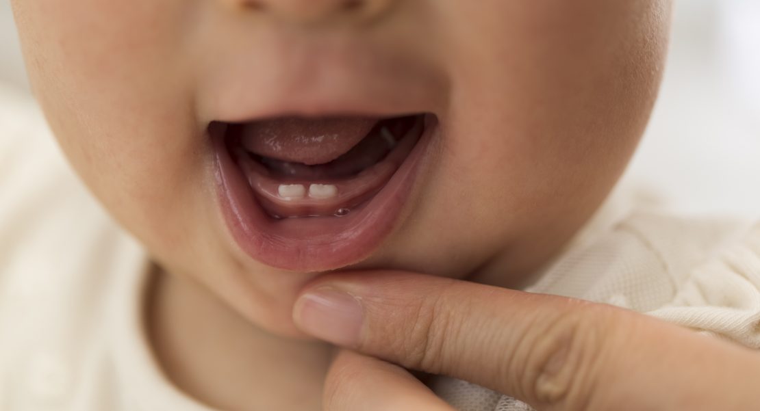 dientes de leche