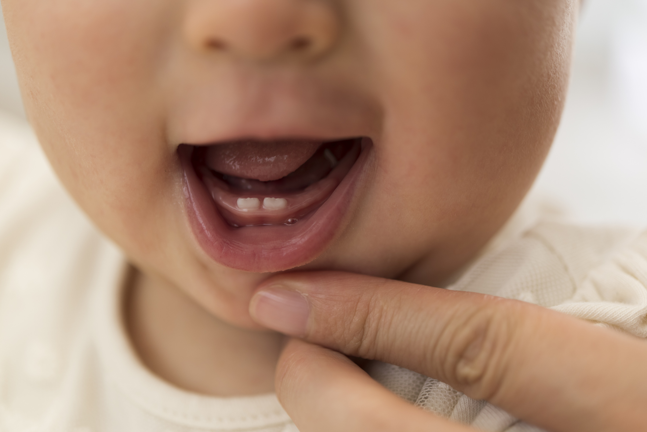dientes de leche