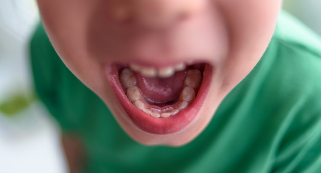 dientes de tiburón