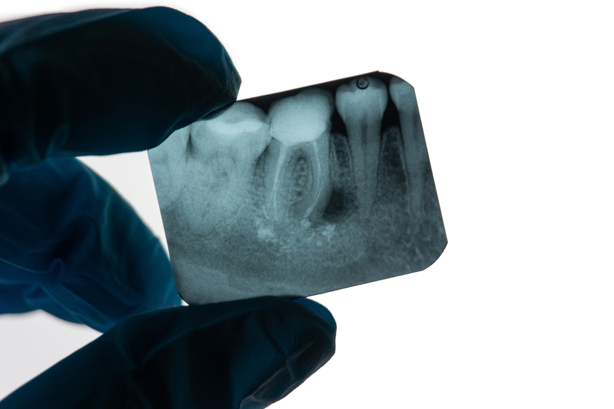 endodoncia