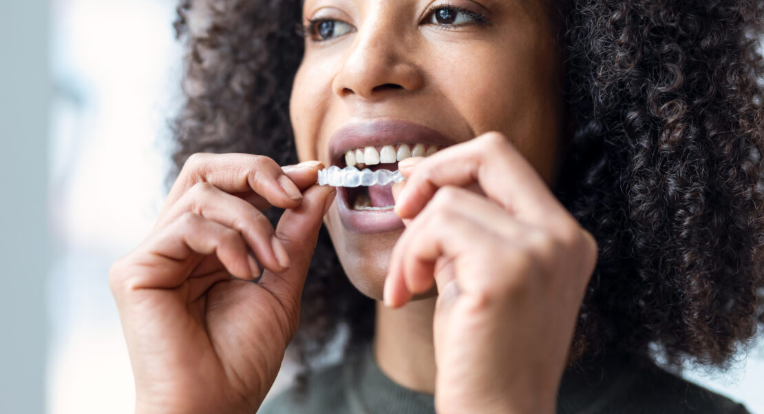 férulas dentales